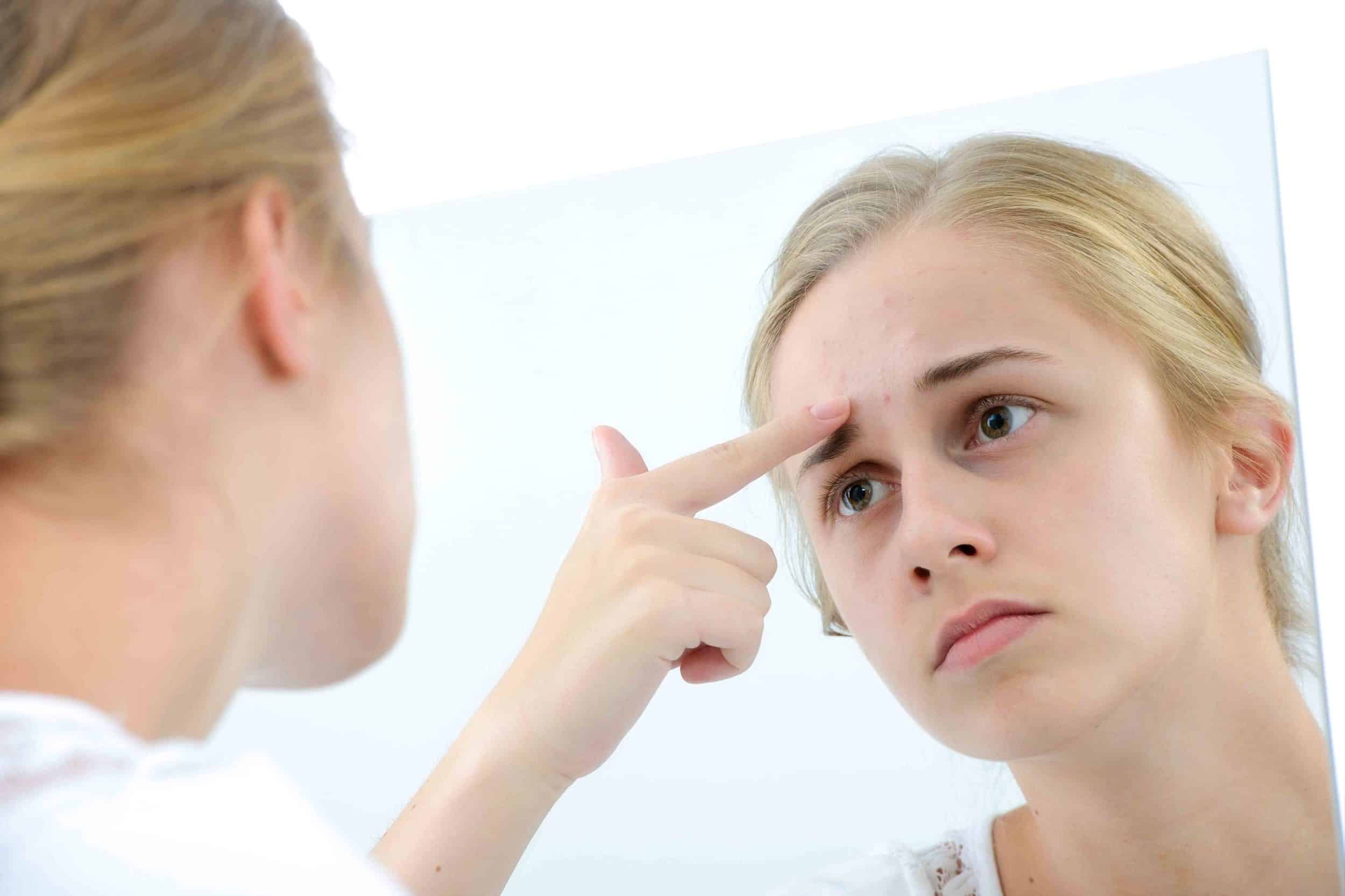 Microneedling Vs IPL: Which Treatment Works Best on Acne Treatment?