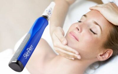 Common Questions People Ask About Microneedling